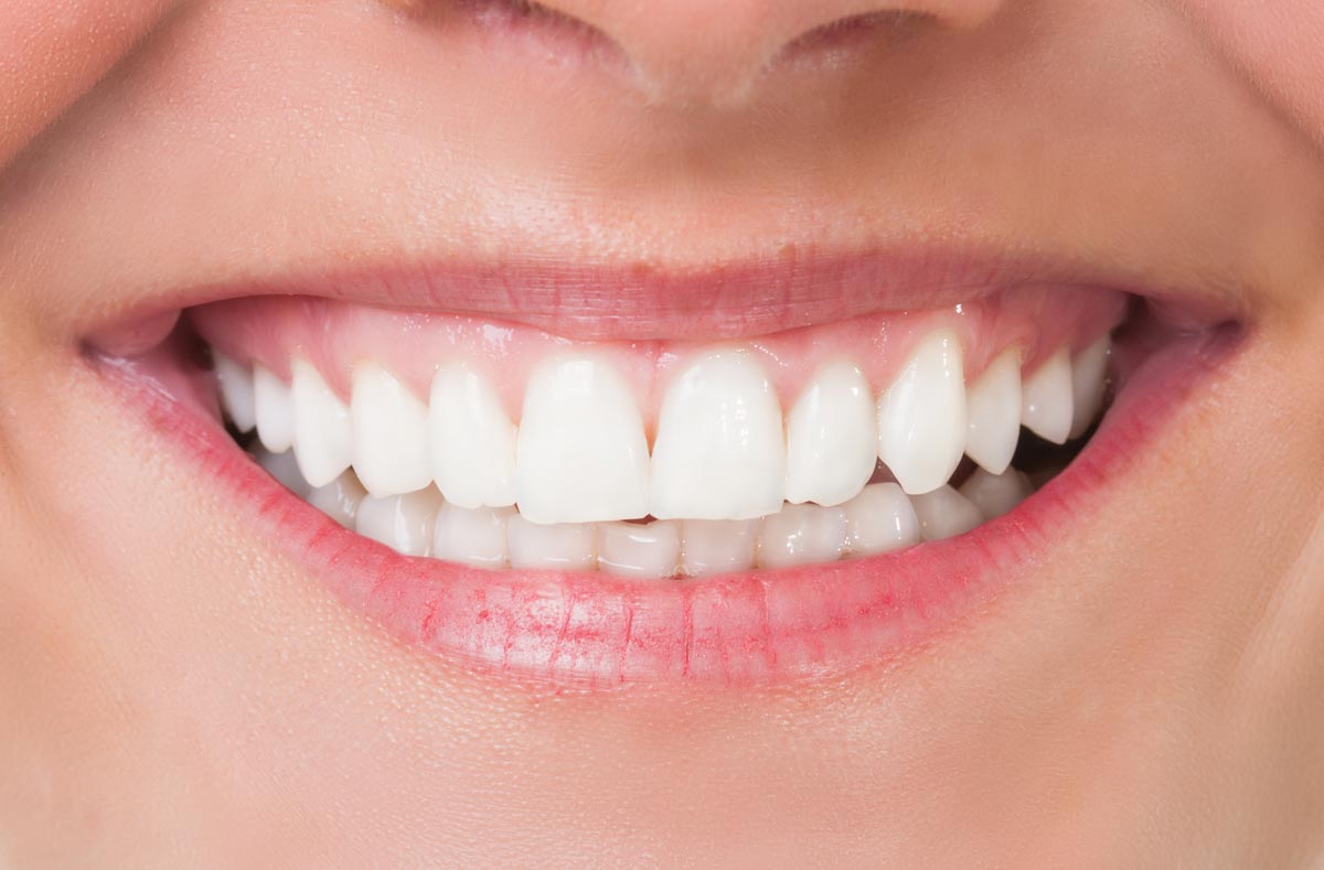 Estetica dentale donna