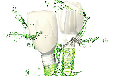 Terapia implantare Terapia implantare
